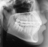 Radiologia Odontológica em Ilhéus